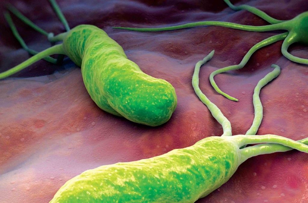 Bacteria Care Infecteaz Stomacul Duce La Gastrit Ulcer I Chiar Cancer