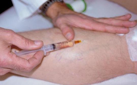 Tratamentul varicozei în kostanay. Ciorapi medicinali compresivi cu varf inchis pana la genunchi 21